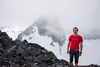 elbow_20160809_57aa3605a964a.jpg